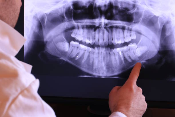 Best Broken Tooth Emergency  in Newton, MS